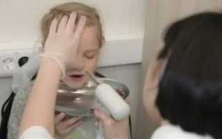 Заложенность носа при ангине