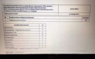 Бак посев из носоглотки