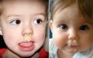 У ребенка сопли внутри но не текут