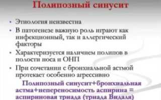 Полипозный полисинусит