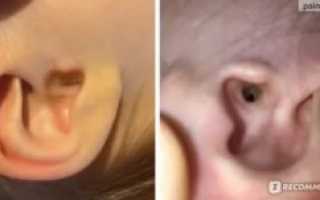 Серная пробка в ухе у ребенка фото