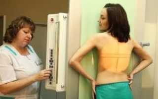 Как проходить флюорографию