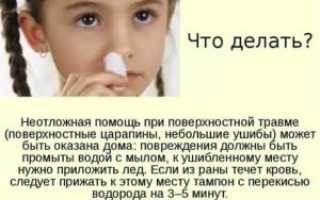 Что делать при ушибе носа