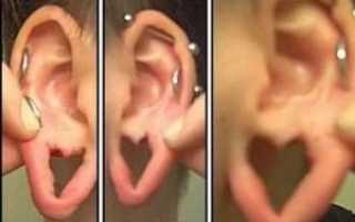 Почему сережки в ушах воняют