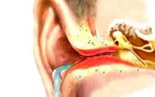 Жидкость в ухе после отита