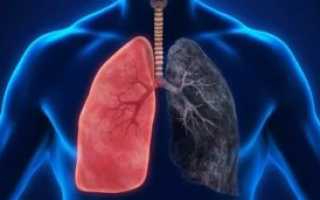 Диагностика легких и бронхов