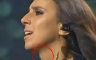 Бывает ли кадык у женщин