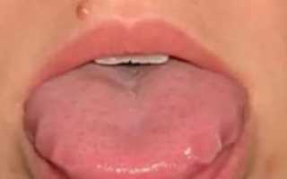 Немеет корень языка причины