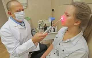 Лечение гайморита лазером