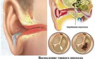 Трещит в ухе при глотании