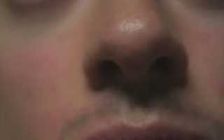 Металлический запах в носу