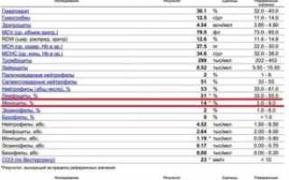Общий анализ крови при коклюше у детей