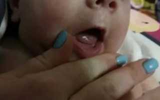 Новорожденный давится слюной