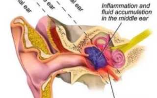 Почему щелкает в ухе причины