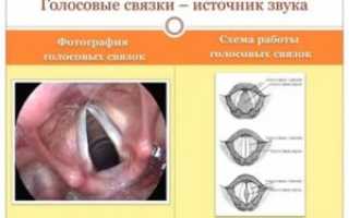 Несмыкание голосовых связок лечение