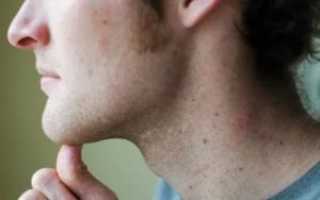 Болит под подбородком посередине