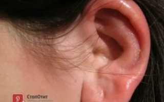 Опухла мочка уха что делать