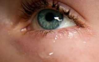 Слезятся глаза при простуде что делать