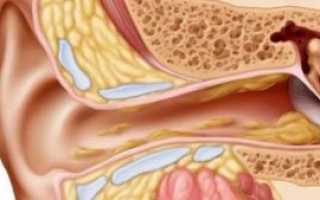Почему в ушах образуется много серы