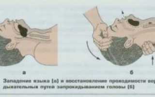 Западает язык во сне причины