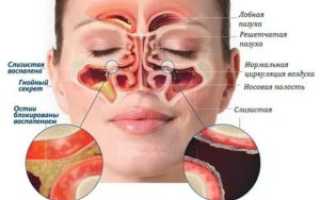 Заложены пазухи носа чем лечить