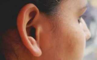 Неприятный запах за ушами у человека причина