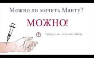 Что нельзя при манту детям