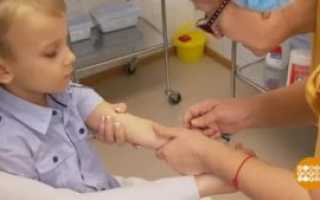 Опасно ли делать манту ребенку