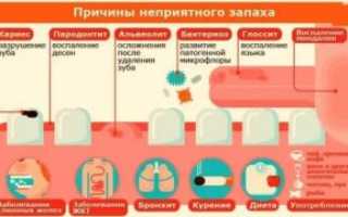 Запах гноя изо рта причины