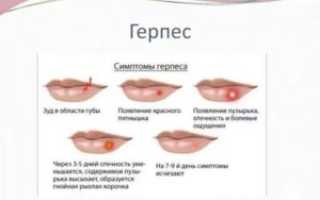 Через сколько проходит простуда на губе