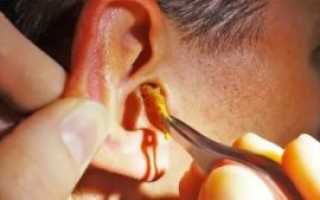 Вытекла сера из уха у ребенка