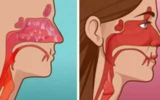 Нос вообще не дышит что делать