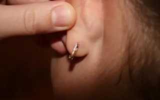 Почему пахнут уши от сережек
