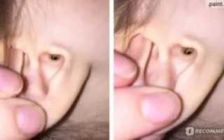 Белая сера в ушах причины