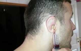 Как сломать ухо без причины и боли