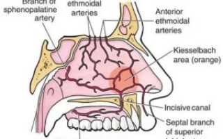 Слабые сосуды в носу лечение