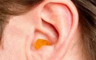 Сухая сера в ушах причины