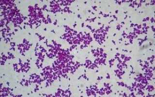 Золотистый стафилококк латинское название