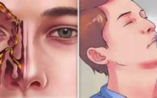 Жжение в носу при вдохе