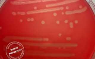 Streptococcus agalactiae у мужчин