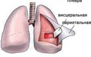 Уплотнение плевры легкого причины