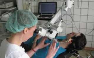 Восстановление барабанной перепонки после отита