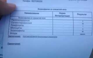 Ринограмма носа расшифровка