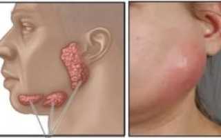 Под челюстью шарик перекатывается