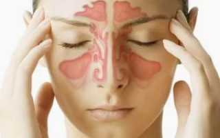 Болит лоб над переносицей