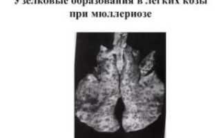 Узелковые образования в легких