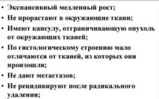 Признаки доброкачественной опухоли