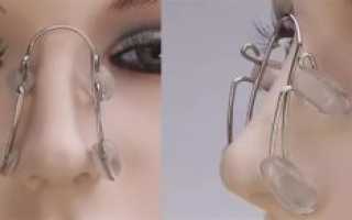 Как выправить нос в домашних условиях