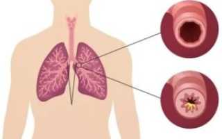 Жжение в бронхах причины