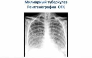 Рентгенография огк что это